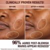 DARK SPOT CORRECTING INVISIBLE UV DUO Hudvårdskit